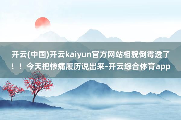 开云(中国)开云kaiyun官方网站相貌倒霉透了！！今天把惨